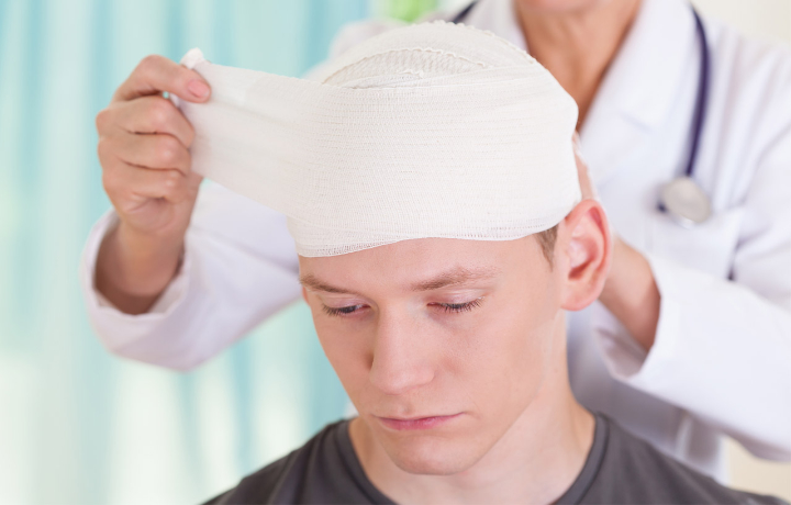 Why Brain Injuries Are Serious And You Need A Good Lawyer